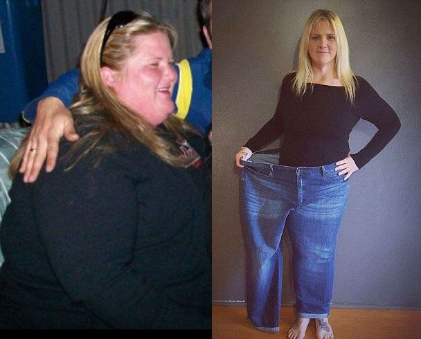 mulher perde 75 kg e pensa em engordar de novo marília notícia