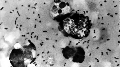 OMS alerta para surto de peste negra começando na África