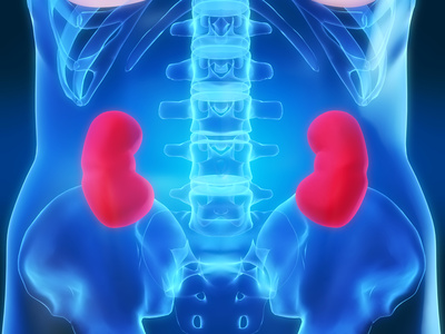 Dia Mundial do Rim: doença renal crônica atinge 10% da população