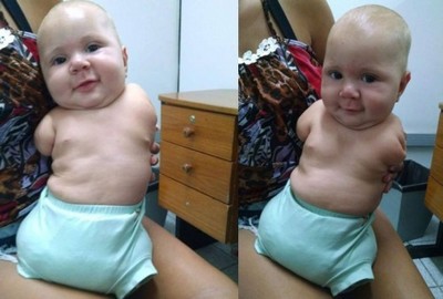 Bebê sem braços e pernas comove os usuários