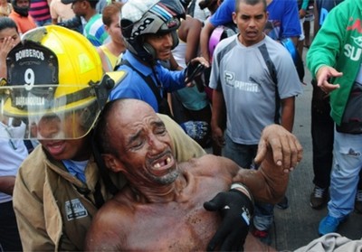 Homem sobrevive após levar choque de mais de 13 mil volts