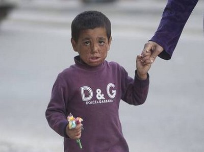 Guerra na Síria desfigura menino