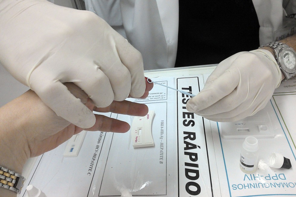 Saúde realiza testes rápidos para HIV no centro