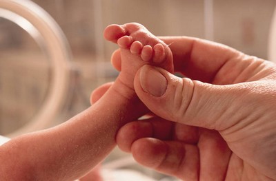 Estudo relata novo dano cerebral em bebê com zika