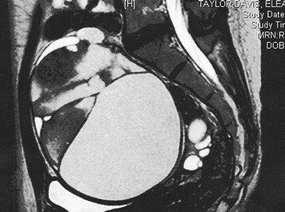 Sexo ajuda inglesa a descobrir tumor ‘alienígena’