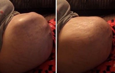 Vídeo mostra bebê ‘frenético’ na barriga