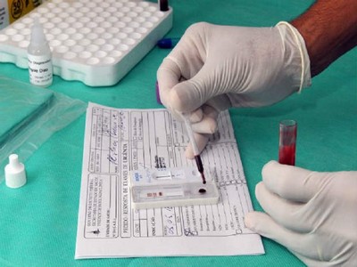 Teste rápido dá resultado de zika em 20 minutos