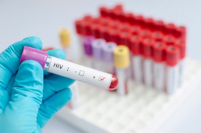 SUS oferecerá remédio que pode prevenir HIV