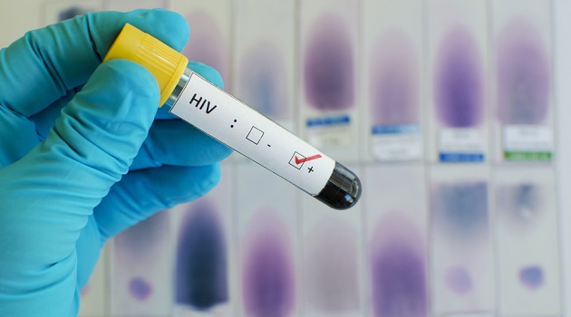 hiv-teste-positivo-_jarun_ontakrai-shutterstock