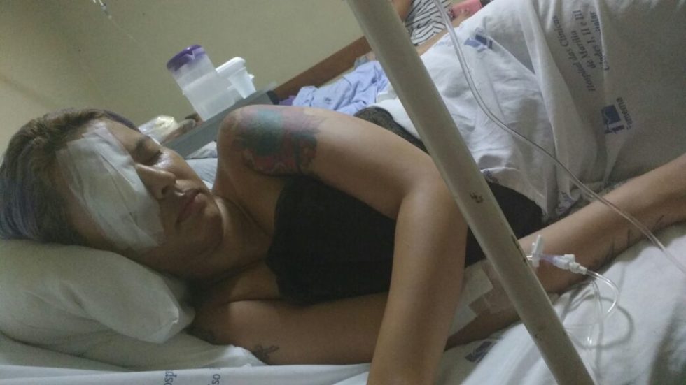 Mulher luta para recuperar visão após tortura de ex