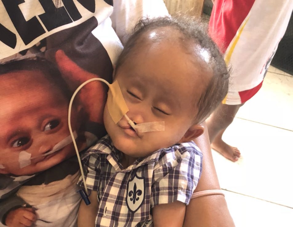 Bebê Joaquim morre aos 6 meses com síndrome rara