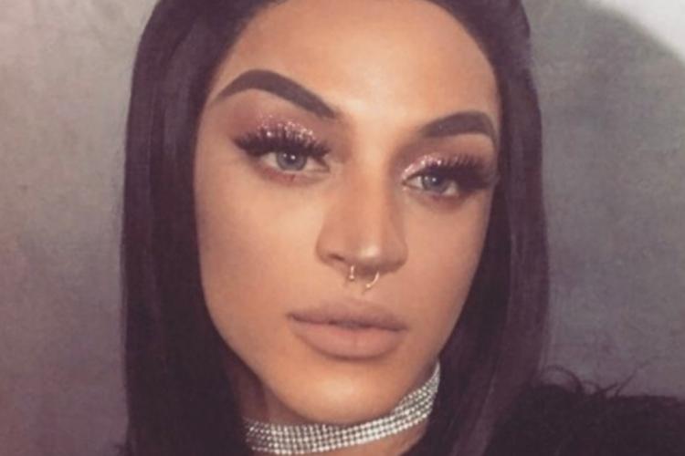 Pabllo Vittar adia gravação após acertar joelhada no próprio olho