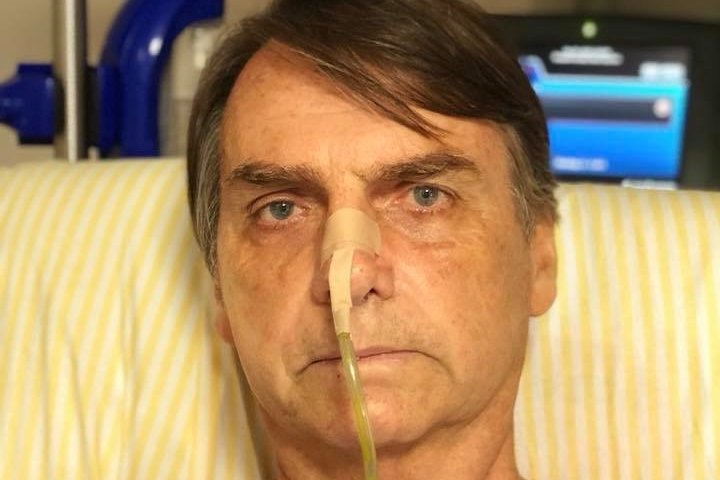 Após febre, Bolsonaro é submetido a tomografia e drenagem