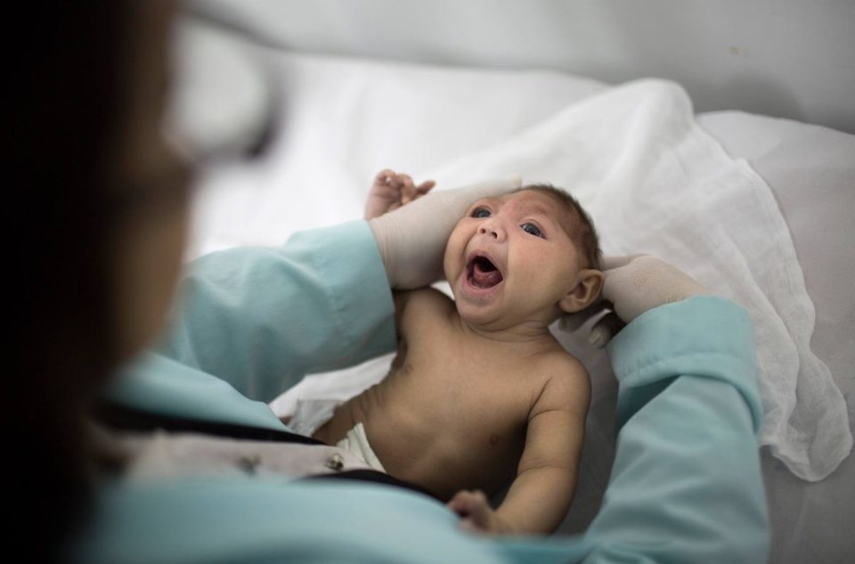 Sequela de zika em bebê pode surgir após 2 anos