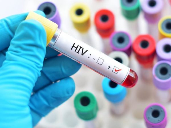 Pesquisadores descrevem novo subtipo do HIV