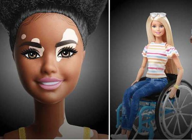 Barbie lança bonecas com vitiligo e sem cabelo