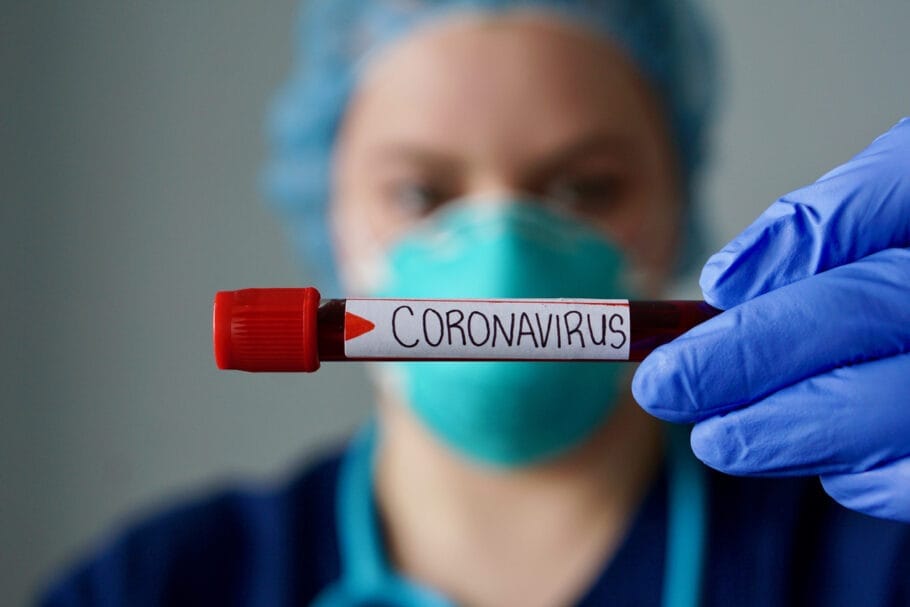 Anvisa dá aval a 8 testes rápidos para coronavírus