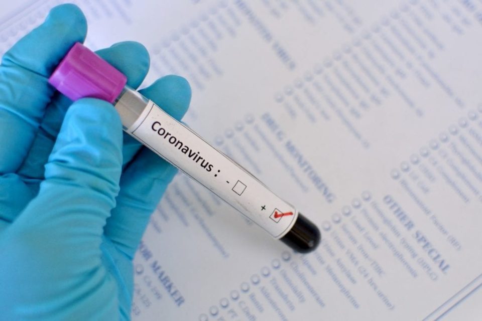 Principais cidades da região somam 34 suspeitas de coronavírus