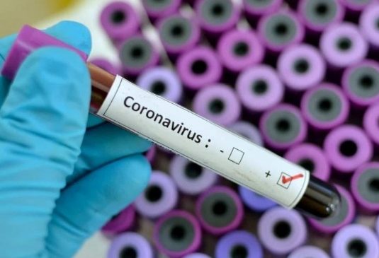 Bauru tem 10 casos suspeitos de coronavírus