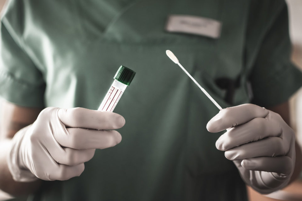 Equipes vão às casas testar coronavírus em Botucatu