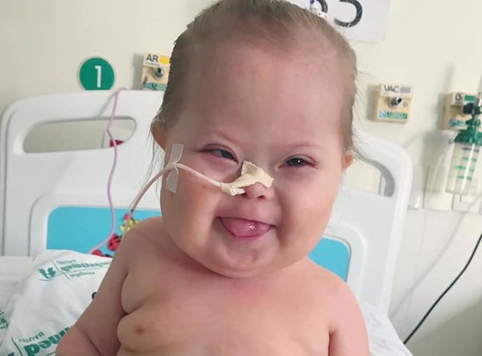 Bebê com síndrome de Down se recupera da Covid-19 e ganha a web