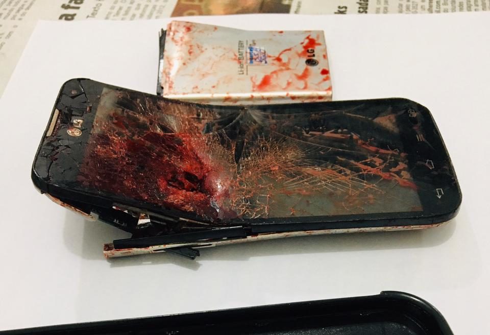 Homem leva dois tiros na zona Oeste e está internado