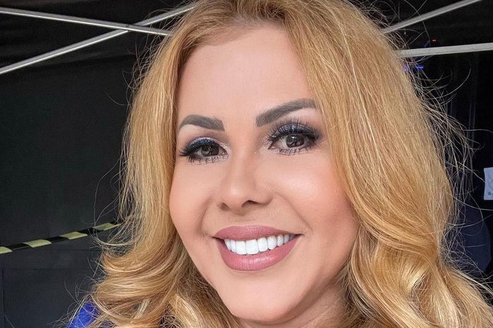 Joelma recebe alta após internação por edema no rosto