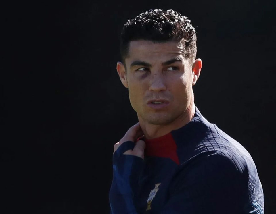 Cristiano Ronaldo treina com olho roxo após pancada