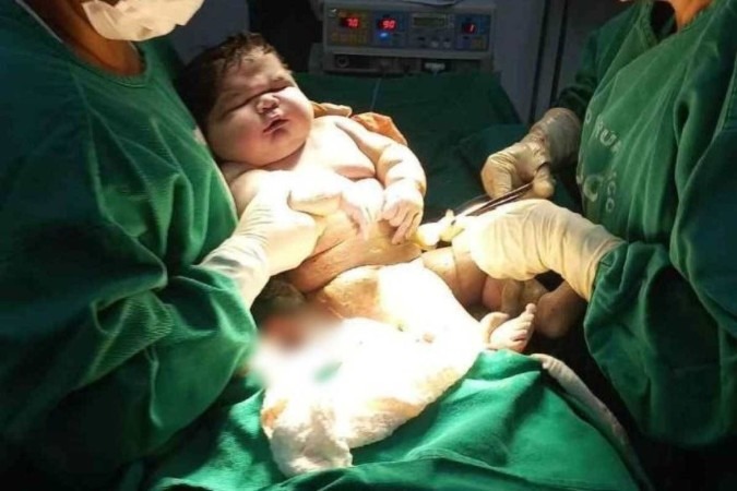 ‘Bebê gigante’ nasce com mais de 7 quilos em Parintins