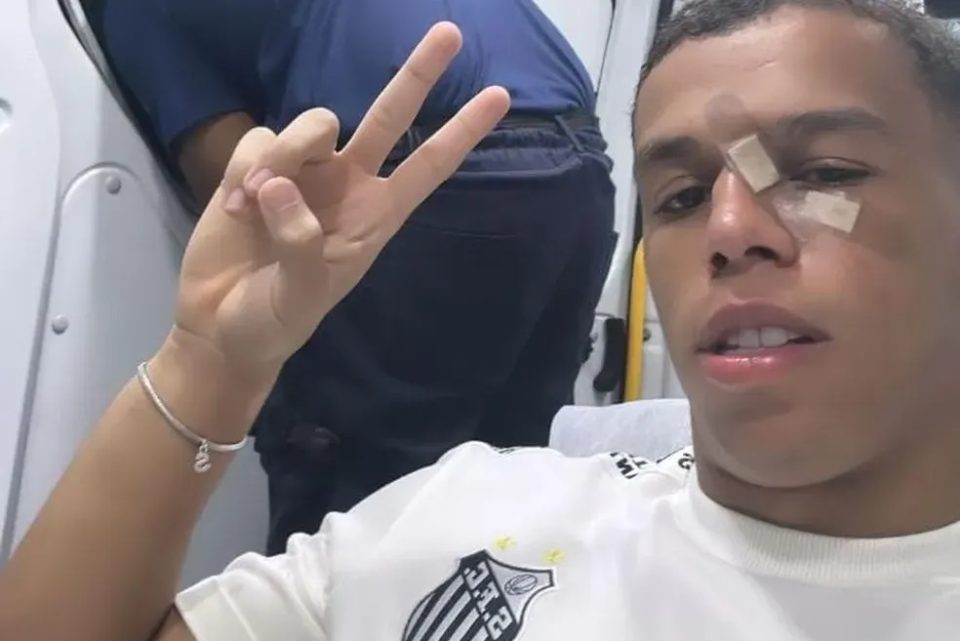 Volante do Santos sofre fratura no nariz e passará por cirurgia