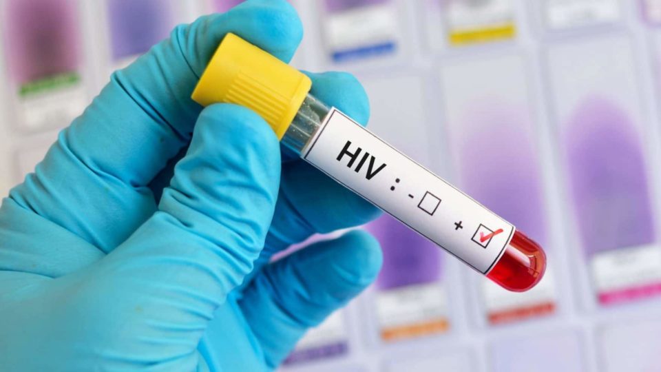 HIV: Cientistas relatam 5º caso de remissão sustentada