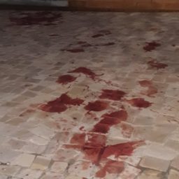 Ataque de pitbulls mata cão maltês e deixa homem gravemente ferido