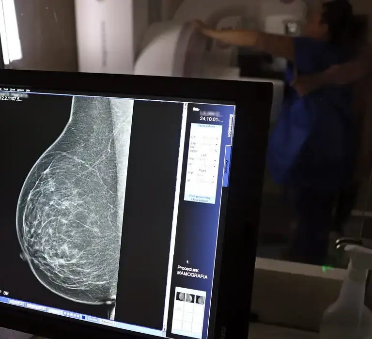 Ministério da Saúde passa a recomendar mamografia a partir dos 40 anos