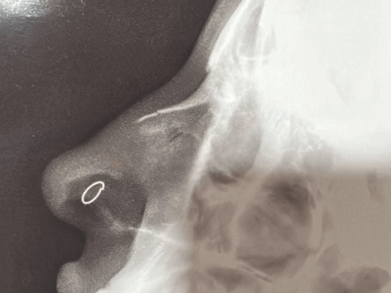 Empresário tenta entrar em festa, tem acesso negado e agride mulher em bar no Centro