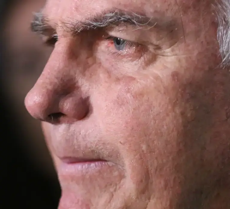 Com nova crise de soluços, Bolsonaro passa por outra cirurgia em Brasília