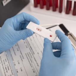 Quase 40 mil brasileiros recebem diagnóstico de HIV e não iniciam tratamento