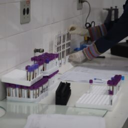 Tupã reorganiza fluxo de exames entre laboratório municipal e Santa Casa