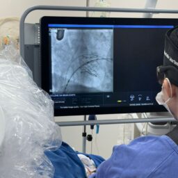 HBU realiza troca inédita de válvula do coração sem cirurgia em Marília
