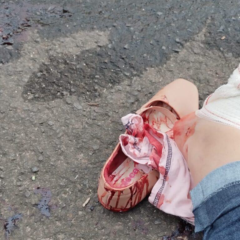 Motociclista é mordida por cão solto em via pública em Marília