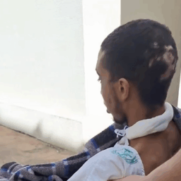 Após luta pela vida, motoboy deixa UTI dois meses depois de acidente em Marília